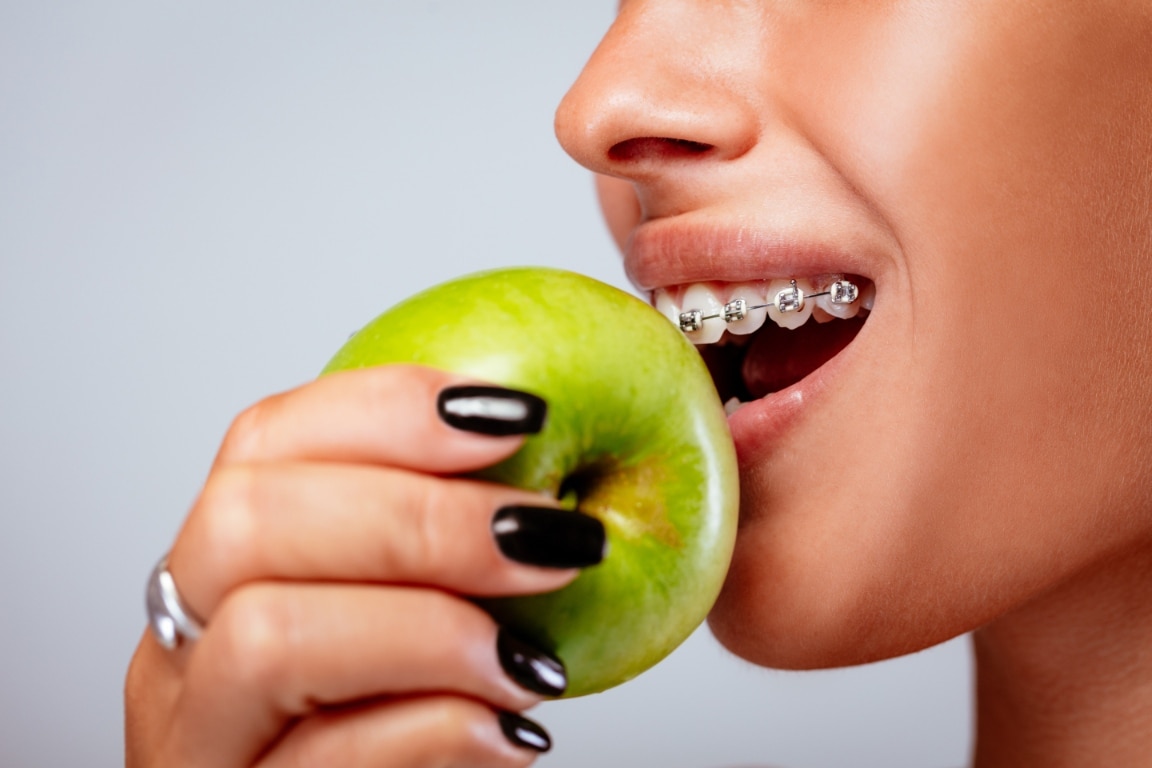girl with braces eating apple
